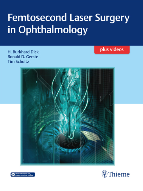 Cover image for book Femtosecond Laser Surgery in Ophthalmology