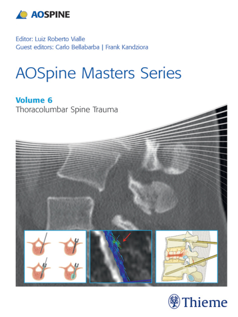 Cover image for book AOSpine Masters Series, Volume 6: Thoracolumbar Spine Trauma