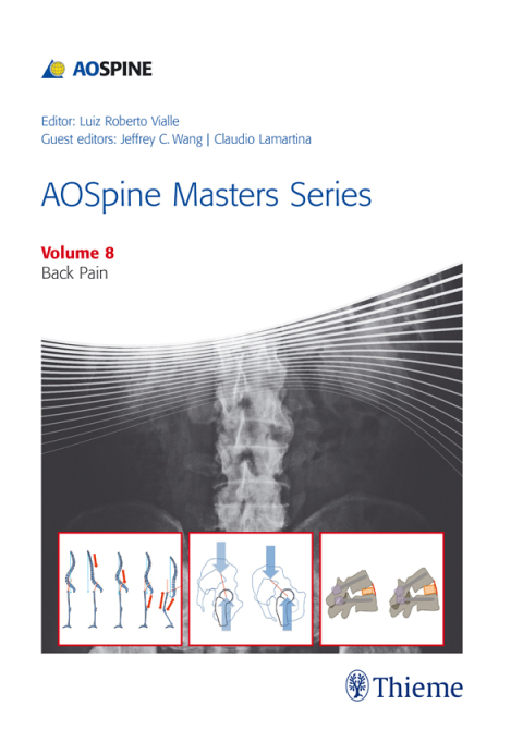 Cover image for book AOSpine Masters Series, Volume 8: Back Pain