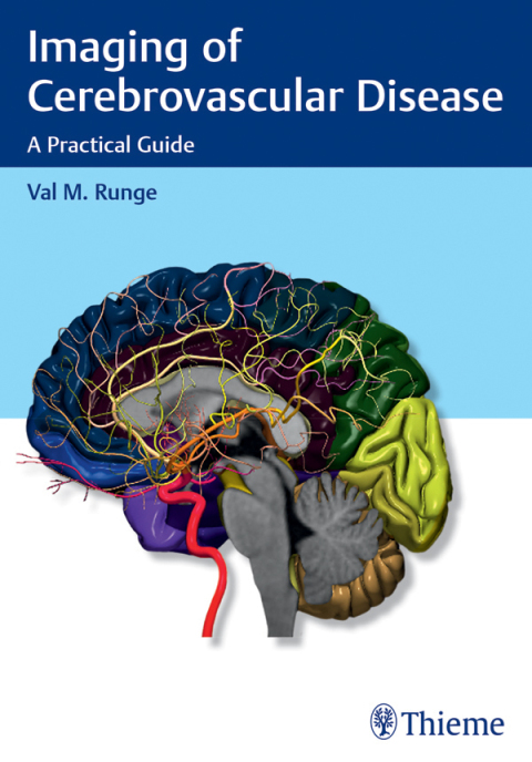 Cover image for book Imaging of Cerebrovascular Disease
