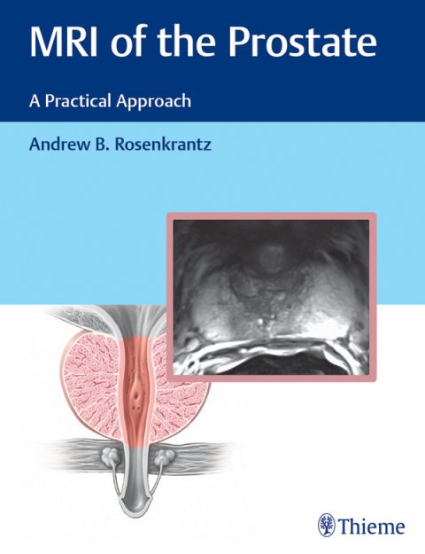 Cover image for book MRI of the Prostate