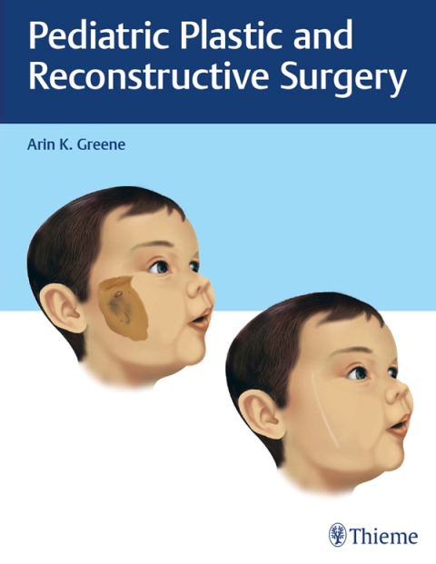 Cover image for book Pediatric Plastic and Reconstructive Surgery