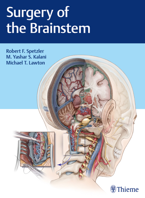 Surgery of the Brainstem 