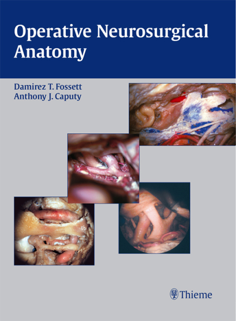Cover image for book Operative Neurosurgical Anatomy