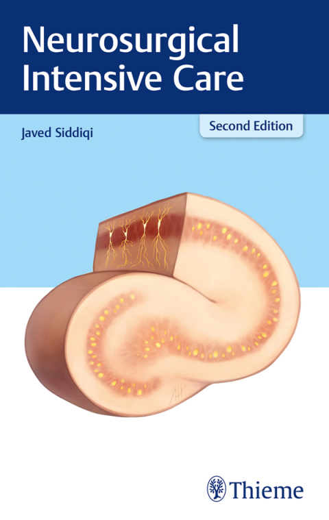 Cover image for book Neurosurgical Intensive Care
