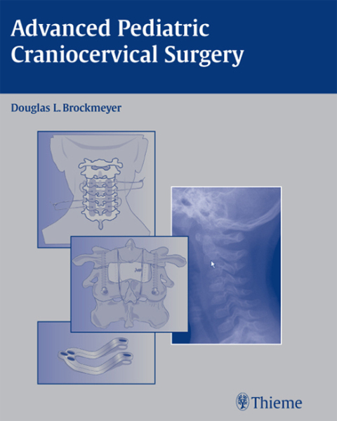 Cover image for book Advanced Pediatric Craniocervical Surgery