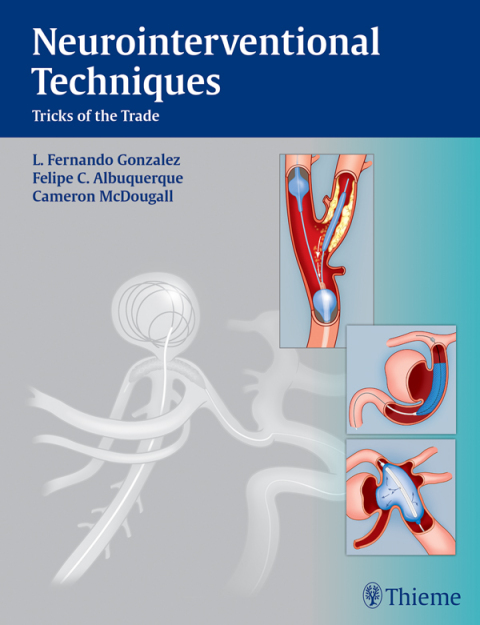 Cover image for book Neurointerventional Techniques