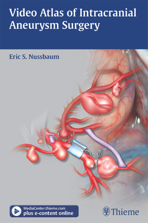 Cover image for book Video Atlas of Intracranial Aneurysm Surgery