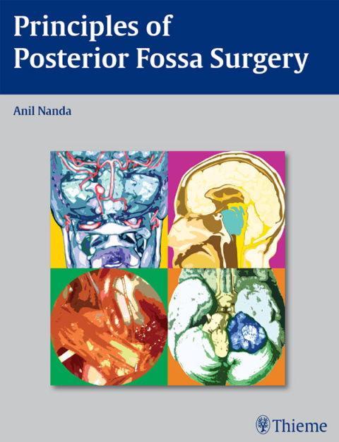 Principles of Posterior Fossa Surgery 