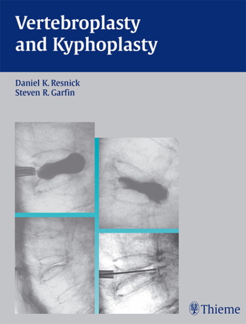 Cover image for book Vertebroplasty and Kyphoplasty