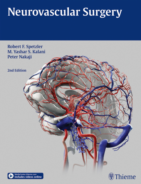 Neurovascular Surgery 