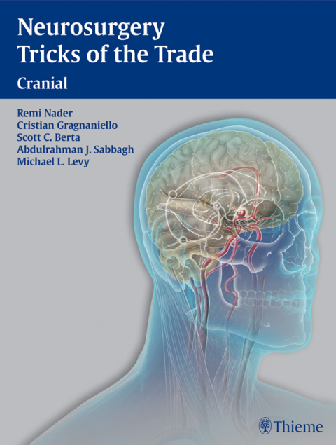 Neurosurgery Tricks of the Trade - Cranial 