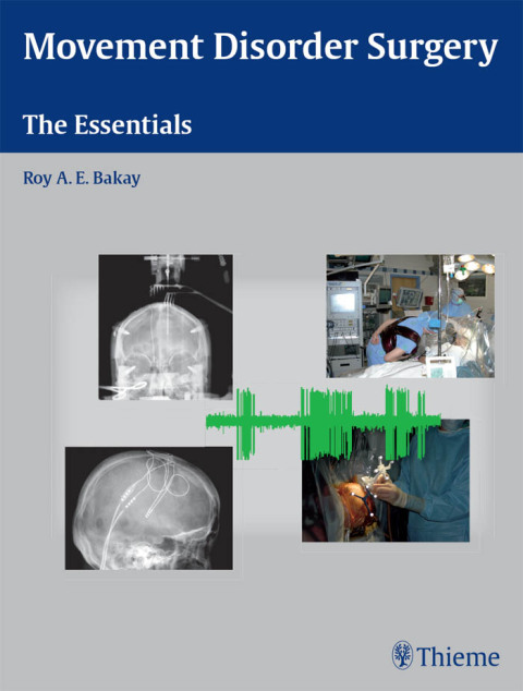 Cover image for book Movement Disorder Surgery