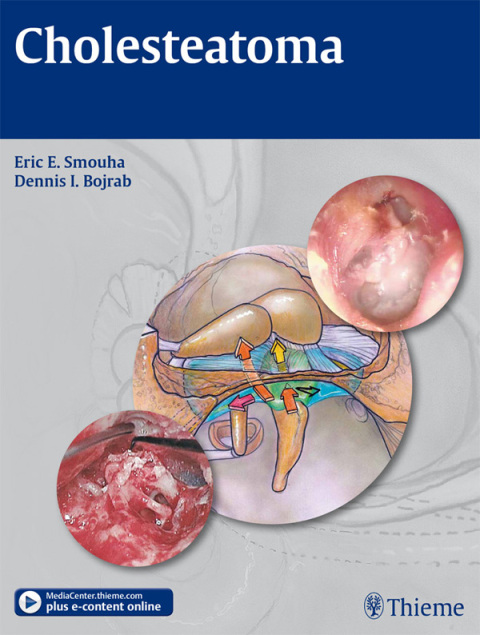 Cover image for book Cholesteatoma