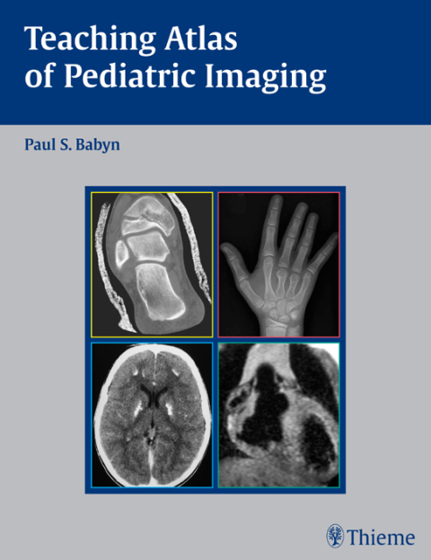 Cover image for book Teaching Atlas of Pediatric Imaging
