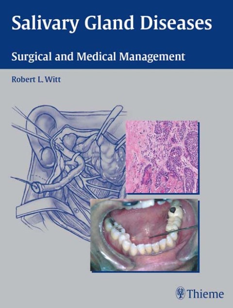 Cover image for book Salivary Gland Diseases