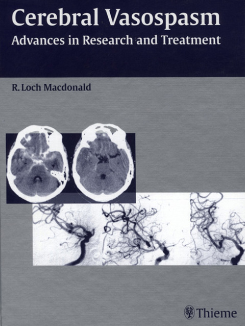 Cover image for book Cerebral Vasospasm