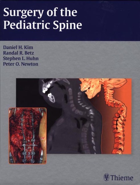 Cover image for book Surgery of the Pediatric Spine