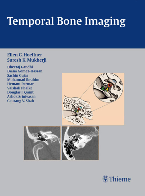 Cover image for book Temporal Bone Imaging