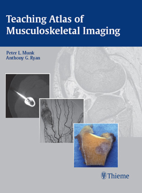 Cover image for book Teaching Atlas of Musculoskeletal Imaging