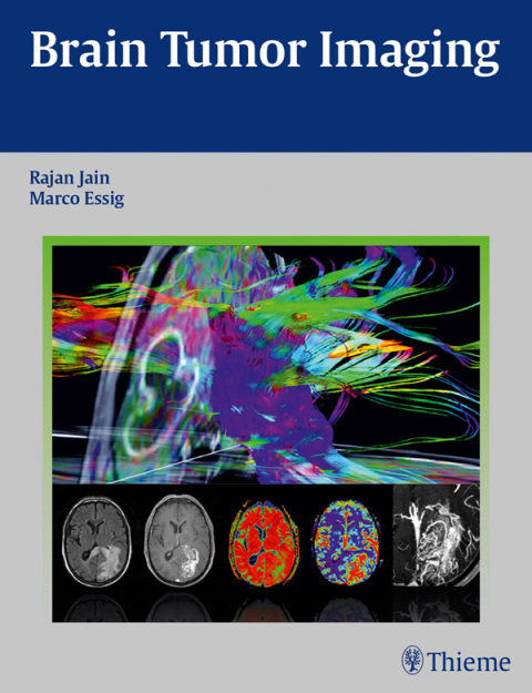 Cover image for book Brain Tumor Imaging