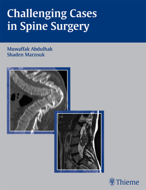 Cover image for book Challenging Cases in Spine Surgery