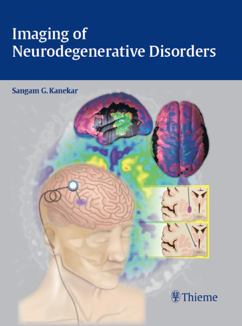 Cover image for book Imaging of Neurodegenerative Disorders