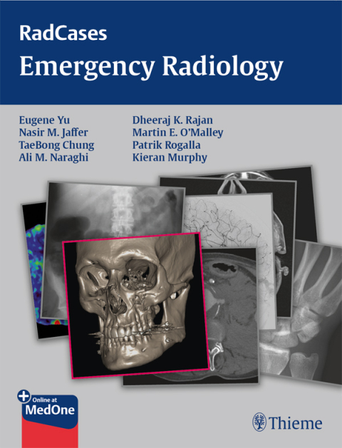 Radcases Emergency Radiology 
