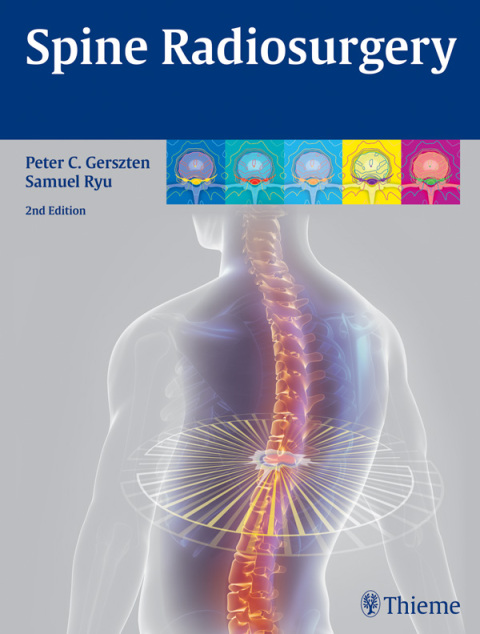 Cover image for book Spine Radiosurgery