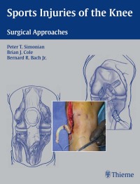 Sports Injuries of the Knee