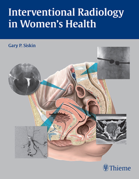 Cover image for book Interventional Radiology in Women's Health