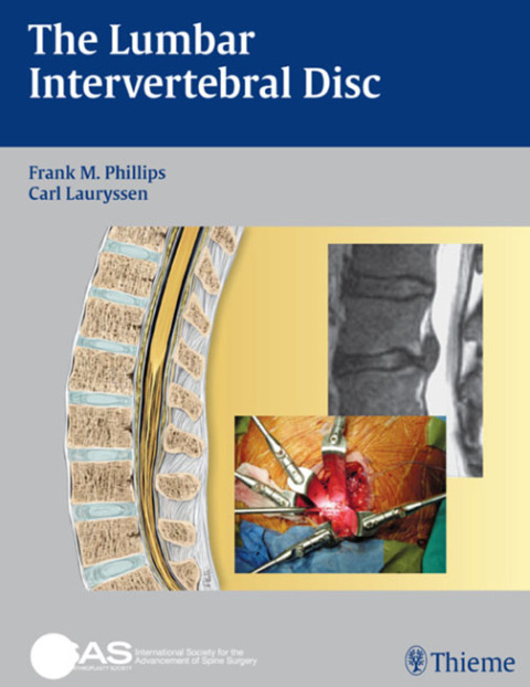Cover image for book The Lumbar Intervertebral Disc