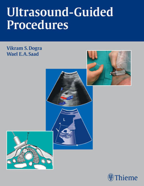 Cover image for book Ultrasound-Guided Procedures
