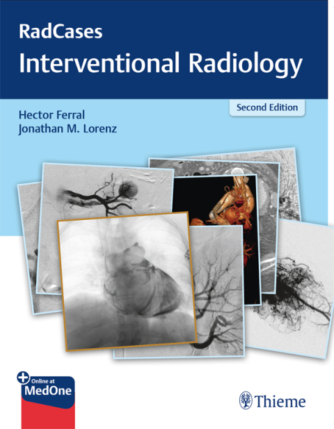 RadCases Q\u0026A Interventional Radiology 