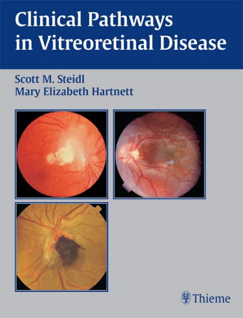 Cover image for book Clinical Pathways In Vitreoretinal Disease