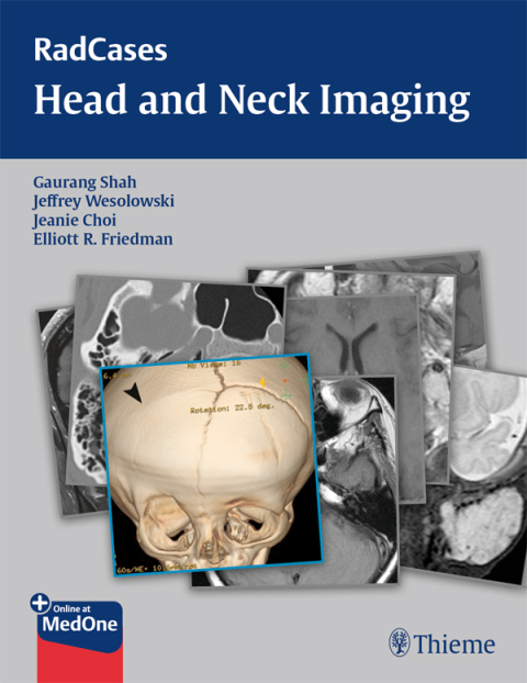 Cover image for book RadCases Head and Neck Imaging