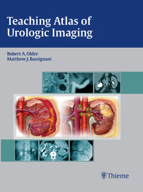 Cover image for book Teaching Atlas of Urologic Imaging