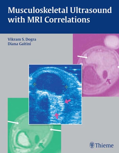 Cover image for book Musculoskeletal Ultrasound with MRI Correlations