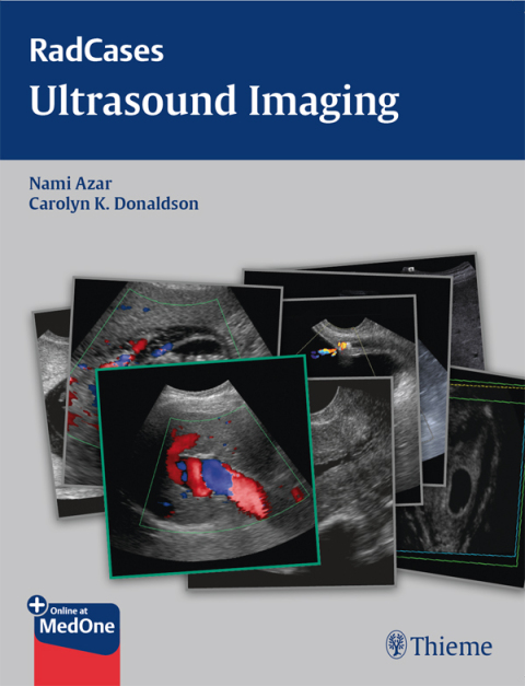 Cover image for book Radcases Ultrasound Imaging