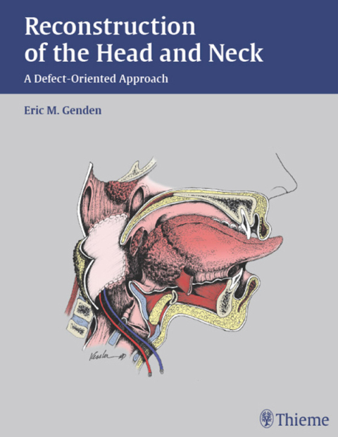 Cover image for book Reconstruction of the Head and Neck