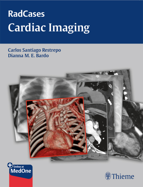 Cover image for book Radcases Cardiac Imaging