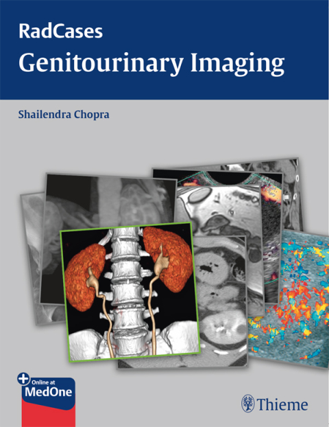 Cover image for book Radcases Genitourinary Imaging