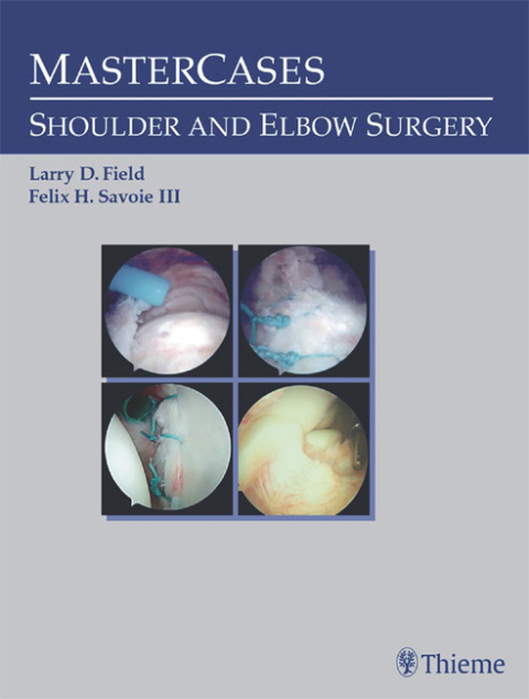 Cover image for book MasterCases in Shoulder and Elbow Surgery