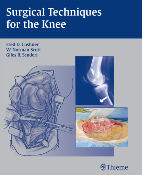 Surgical Techniques for the Knee 