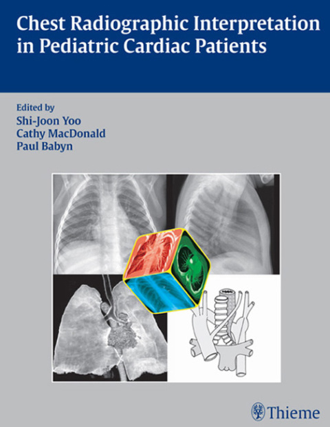 Cover image for book Chest Radiographic Interpretation in Pediatric Cardiac Patients