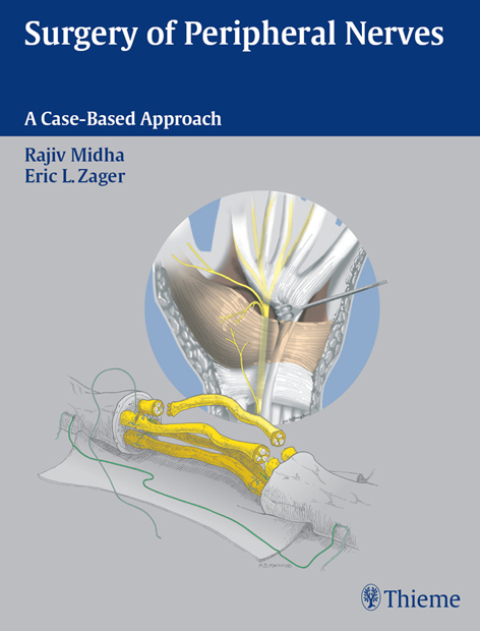 Cover image for book Surgery of Peripheral Nerves