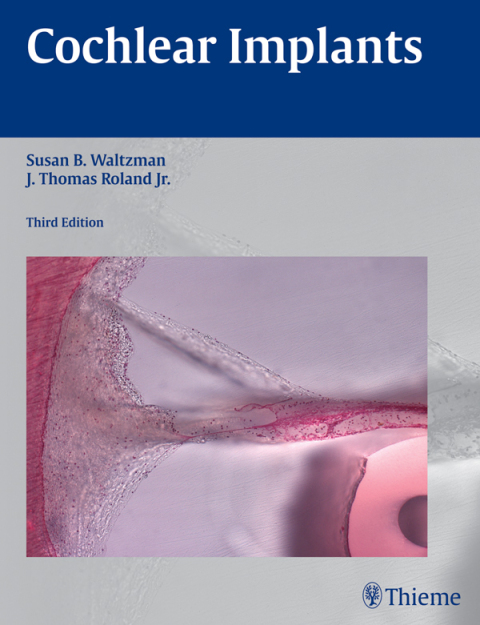 Cover image for book Cochlear Implants