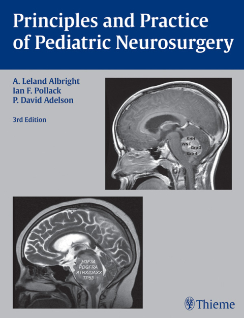 Principles and Practice of Pediatric Neurosurgery 