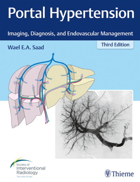 Cover image for book Portal Hypertension