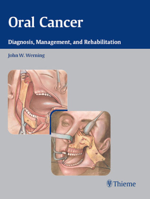 Cover image for book Oral Cancer